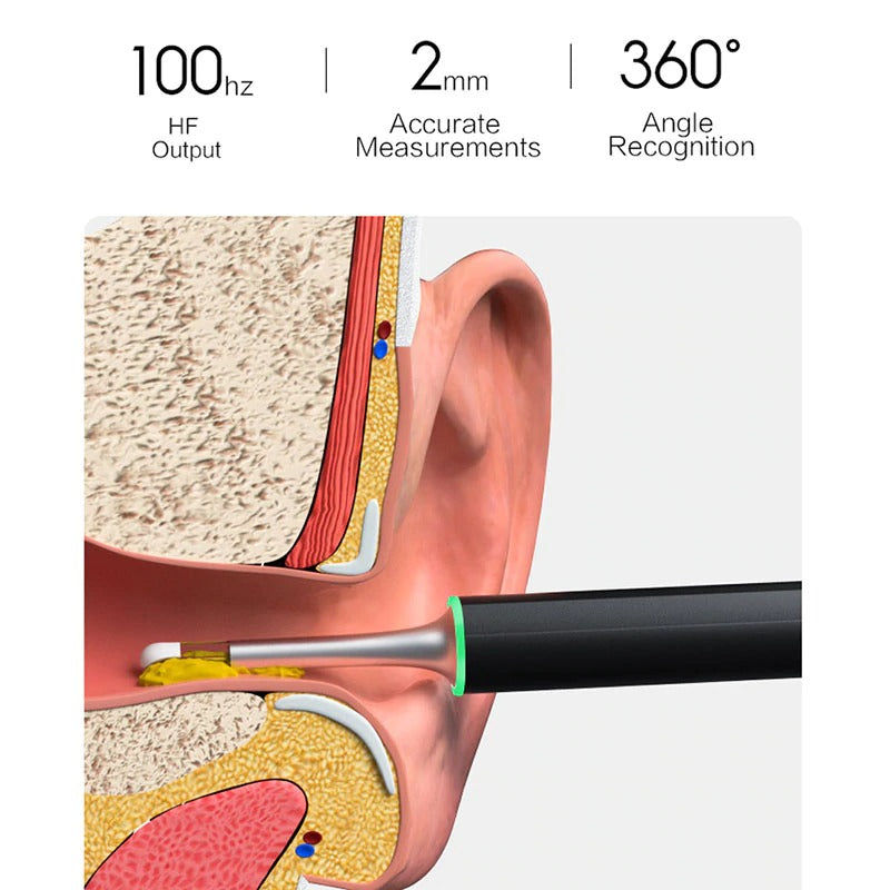 New Bebird X17 Pro Smart Visual Ear Cleaning With Camera